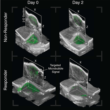 Image: 3-D Ultrasound Molecular Imaging (USMI) images of nonresponder and responder pancreatic xenografts before (day 0) and after (day 2) treatment. The grayscale image shows a volume of the tumor and surrounding tissue. The green region is the molecular signal (Photo courtesy of the University of North Carolina).